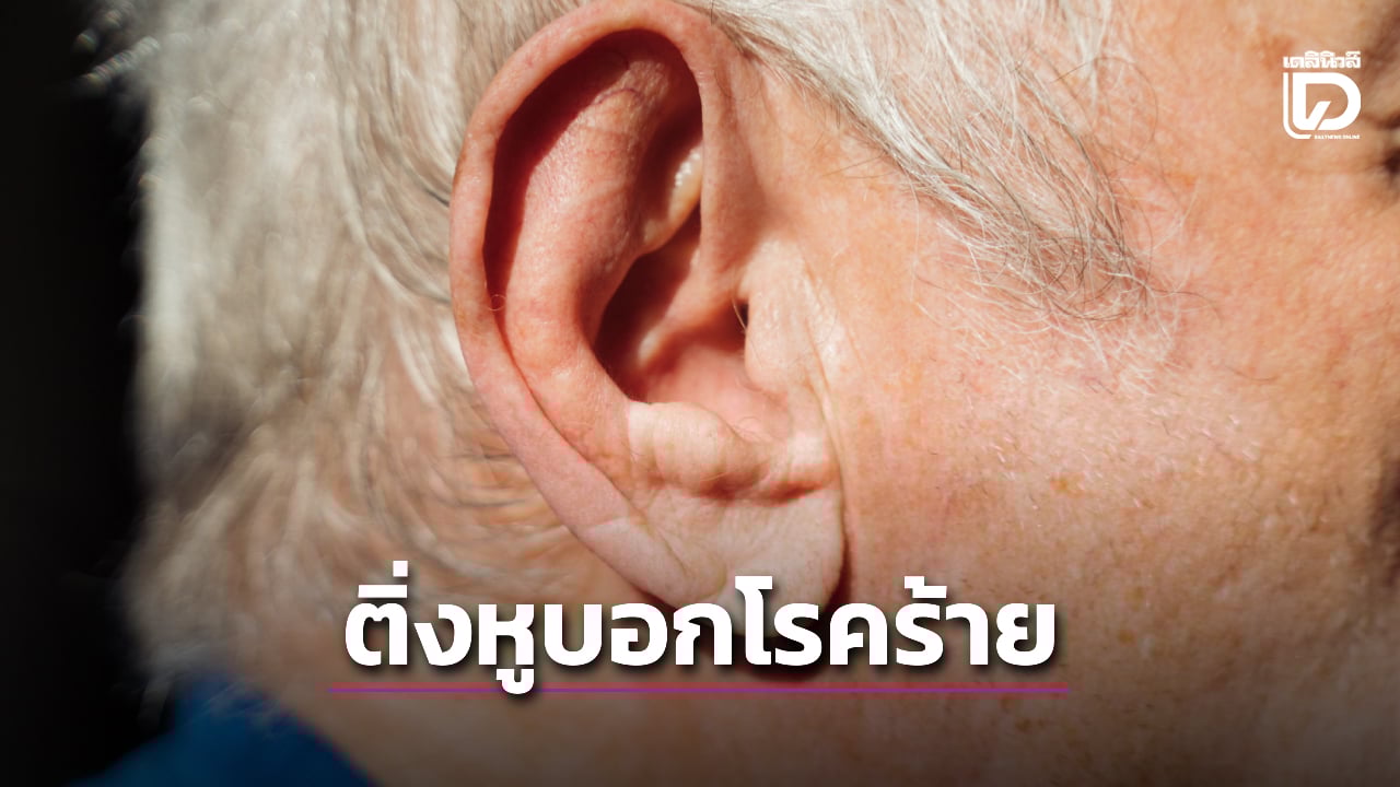 ระวัง!-รอยแบบนี้ที่ติ่งหู-เป็นสัญญาณบอกโรคร้าย-|-เดลินิวส์