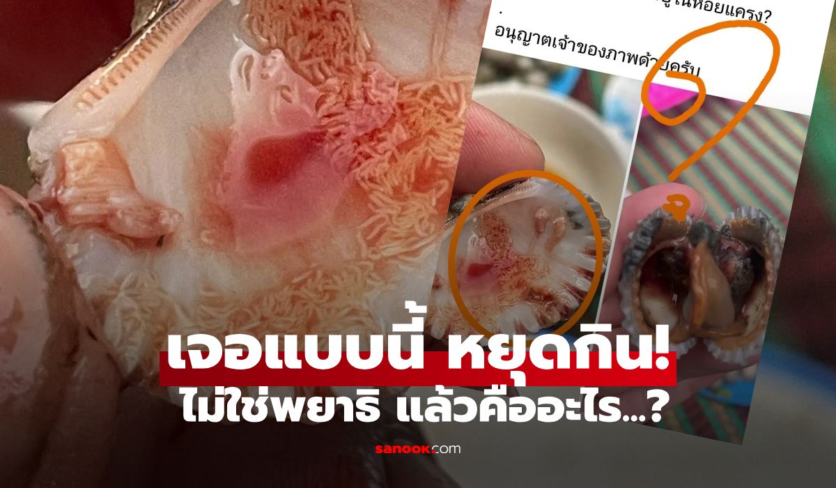 ภาพสะพรึง!-สิ่งแปลกปลอมใน-“หอยแครง”-กูรูชี้ไม่ใช่พยาธิ-แต่เจอแบบนี้ควรหยุดกินทันที